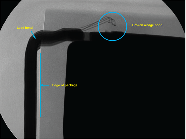 Figure A-3. This x-ray image shows a side view of a package with excessively close leadbending to the package body. No clamping of the leads was used. The result was that the wire wedge bond was broken due to physical trauma upon the lead due to the bend without clamping.